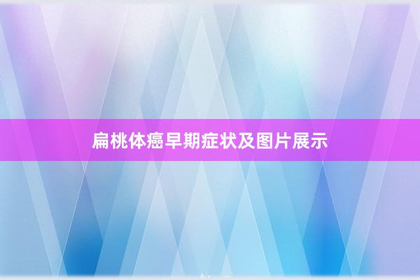 扁桃体癌早期症状及图片展示